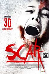 Scar 3D